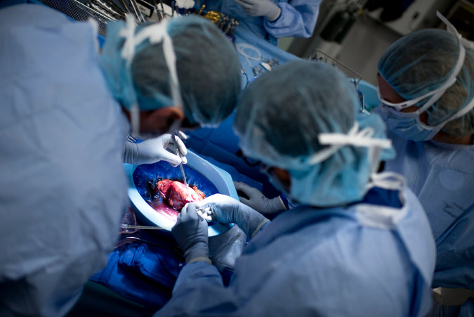 H.I.V.-Positive Organ Transplants in U.S.
